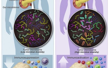 Bağırsak Mikrobiyotası Pankreas Kanserine Umut Olabilir